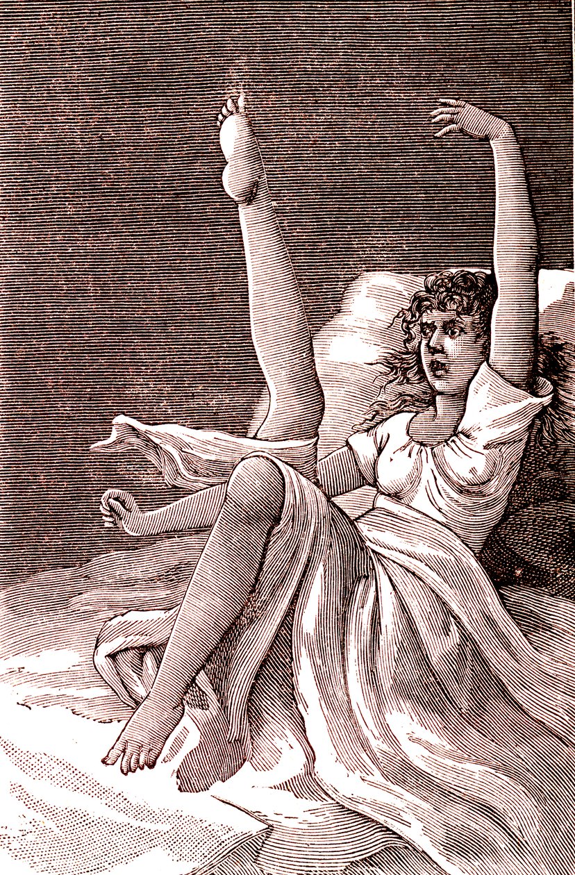 Hysteri, ett extremt mentalt fenomen, psykoser och psykoneuros.1887 (gravyr) av French School