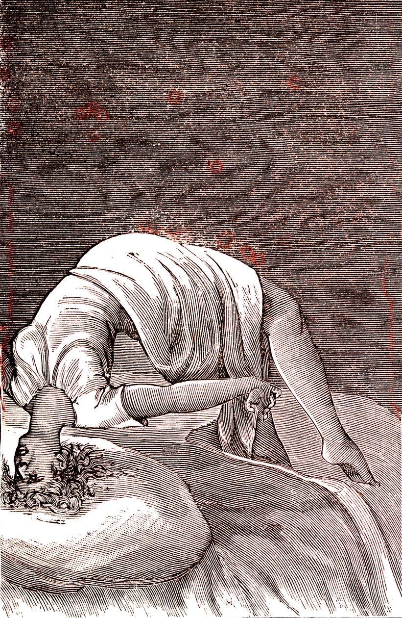 Hysteri, psykisk och nervös störning, som härrör från intensiv ångest. 1887 (gravyr) av French School