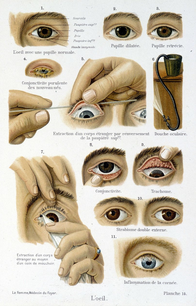 Medicin: ögat. av French School