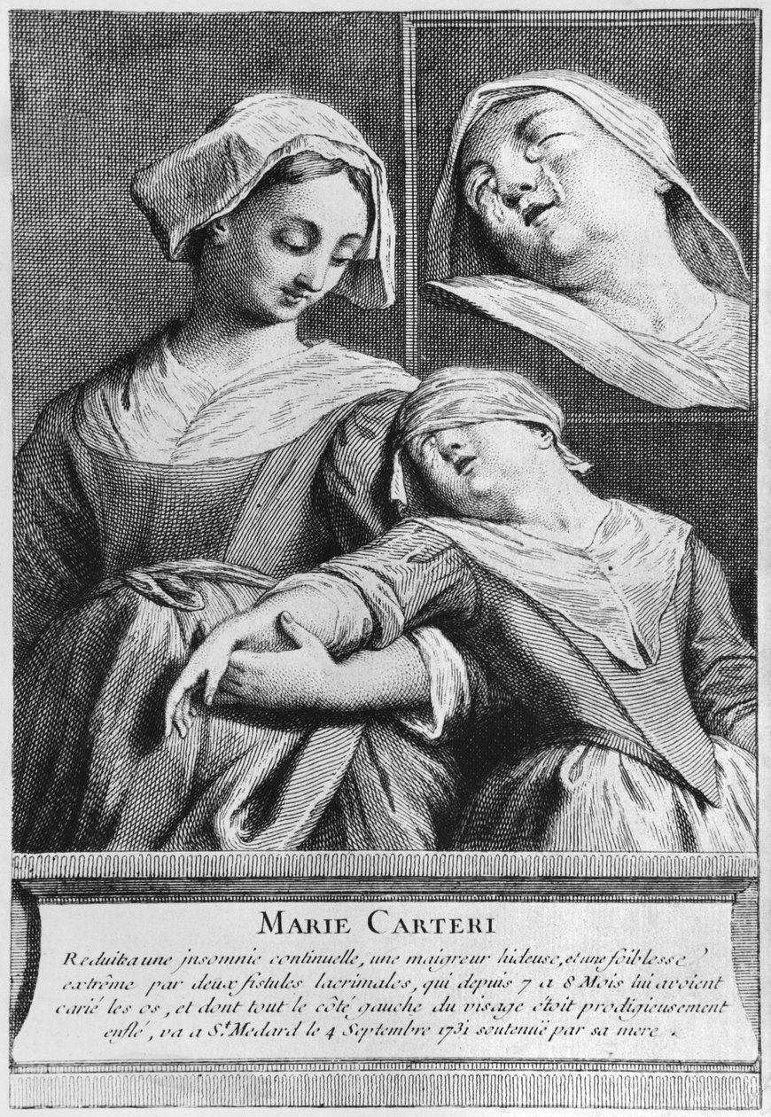 Mirakulöst helande av en blind kvinna, Marie Carteri, på diakon Francois de Pariss grav på församlingskyrkogården Saint-Medard i Paris av French School