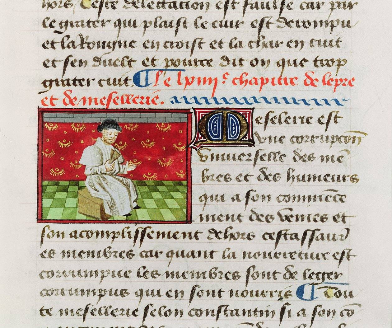 Ms.Fr.22532 Fol.118 Leper, från The Book of the Properties of Things av Barthelemy lAnglais av French School