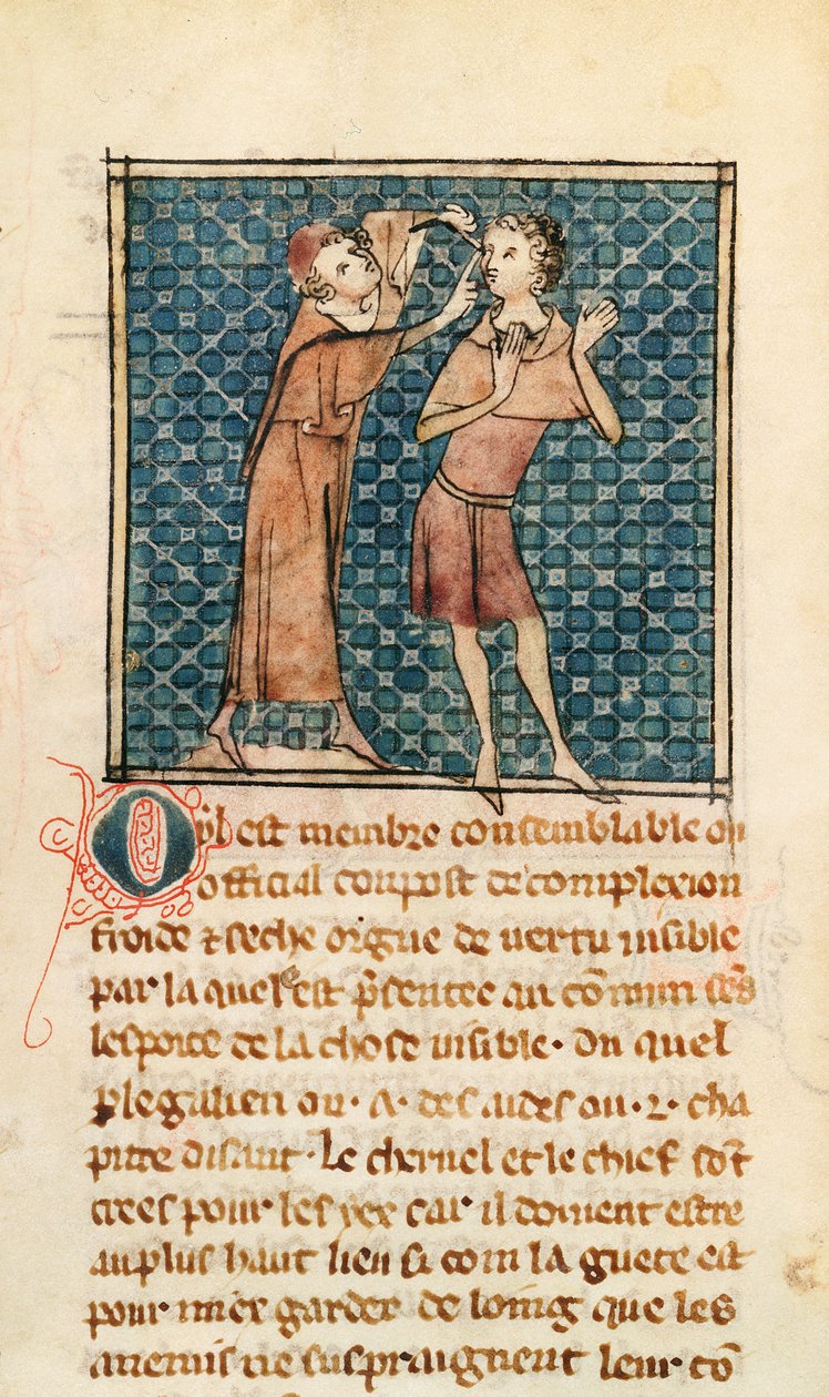 Ms 2030 fol.17 Oftalmologi, illustration från La Chirurgie de Maitre Henri de Mondeville av French School