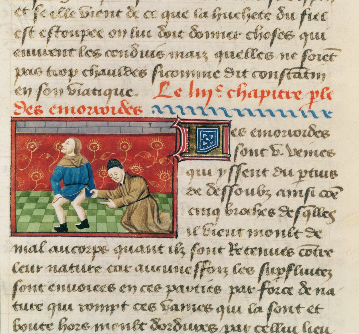 Ms 22532 Undersökning av en patient med hemorrojder, från Le Livre des Proprietes des Choses av Barthelemy lAnglais, ca. 1410-15 av French School