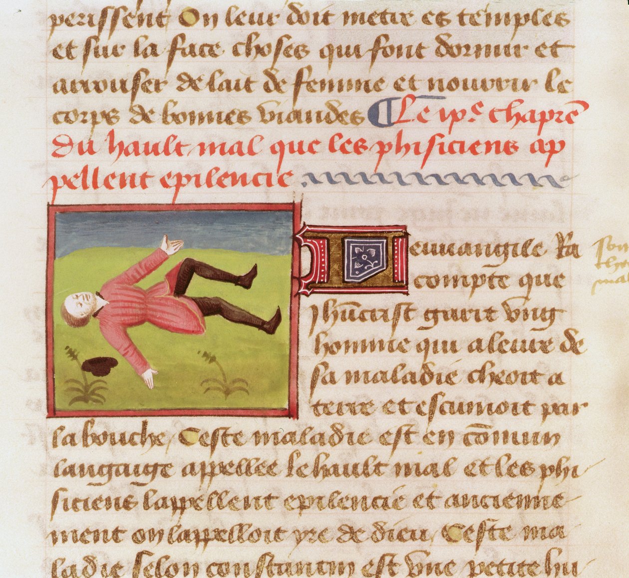 Ms 22532 Patient som lider av ett epileptiskt anfall, från The Book of the Properties of Things av Barthelemy lAnglais, ca. 1410-15 av French School