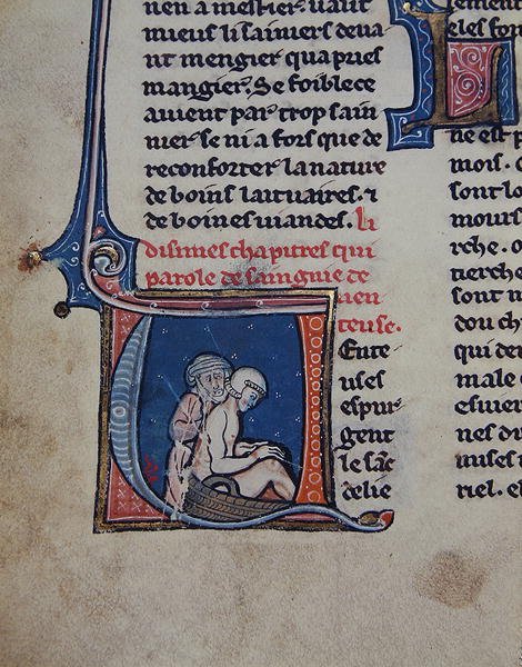 Ms 2510 Auskultation av en sjuk man (vellum) av French School