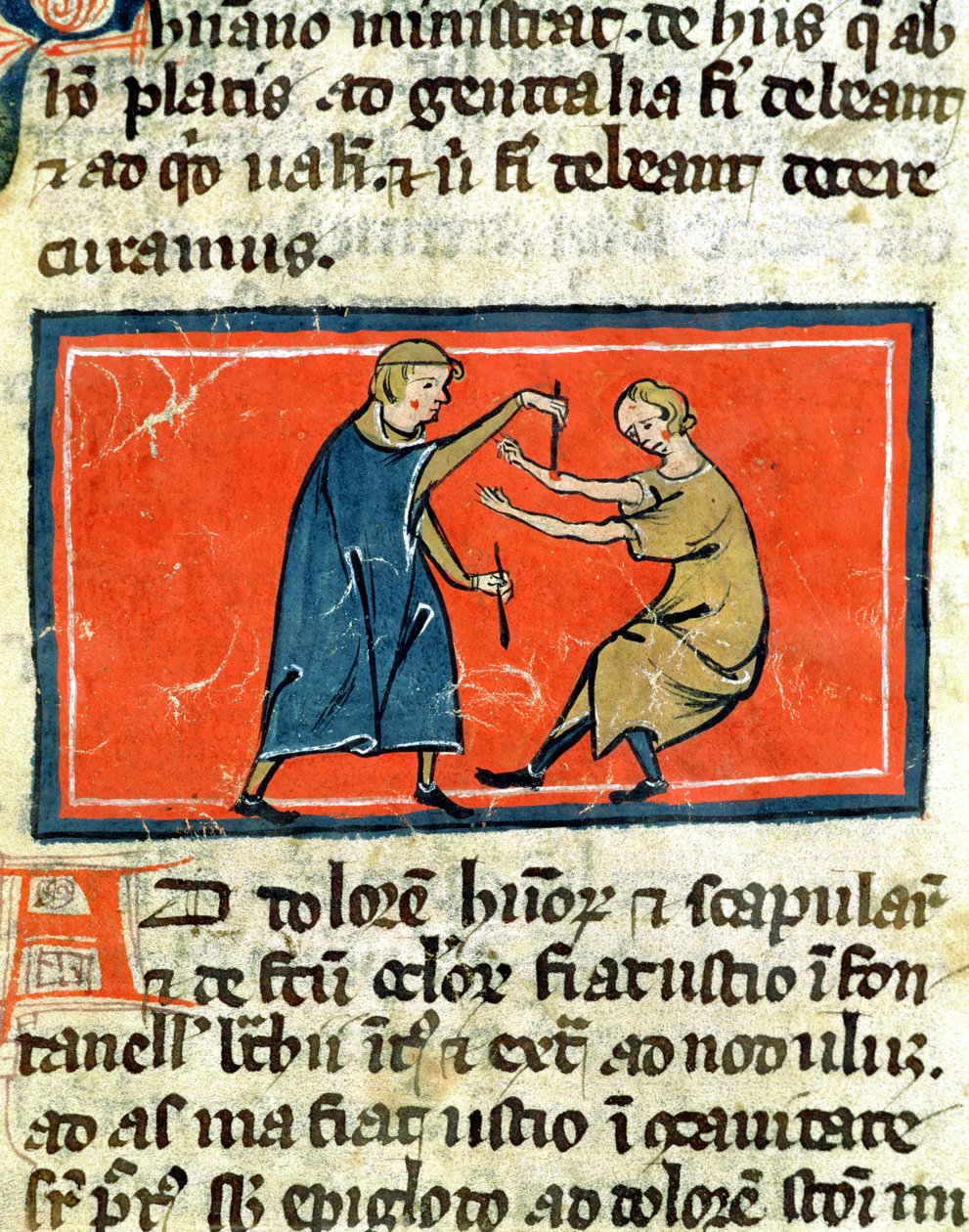 Ms H 89 Doktor som bränner ett sår med eld, från en upplaga av Book of Surgery av Rogier de Salerne av French School