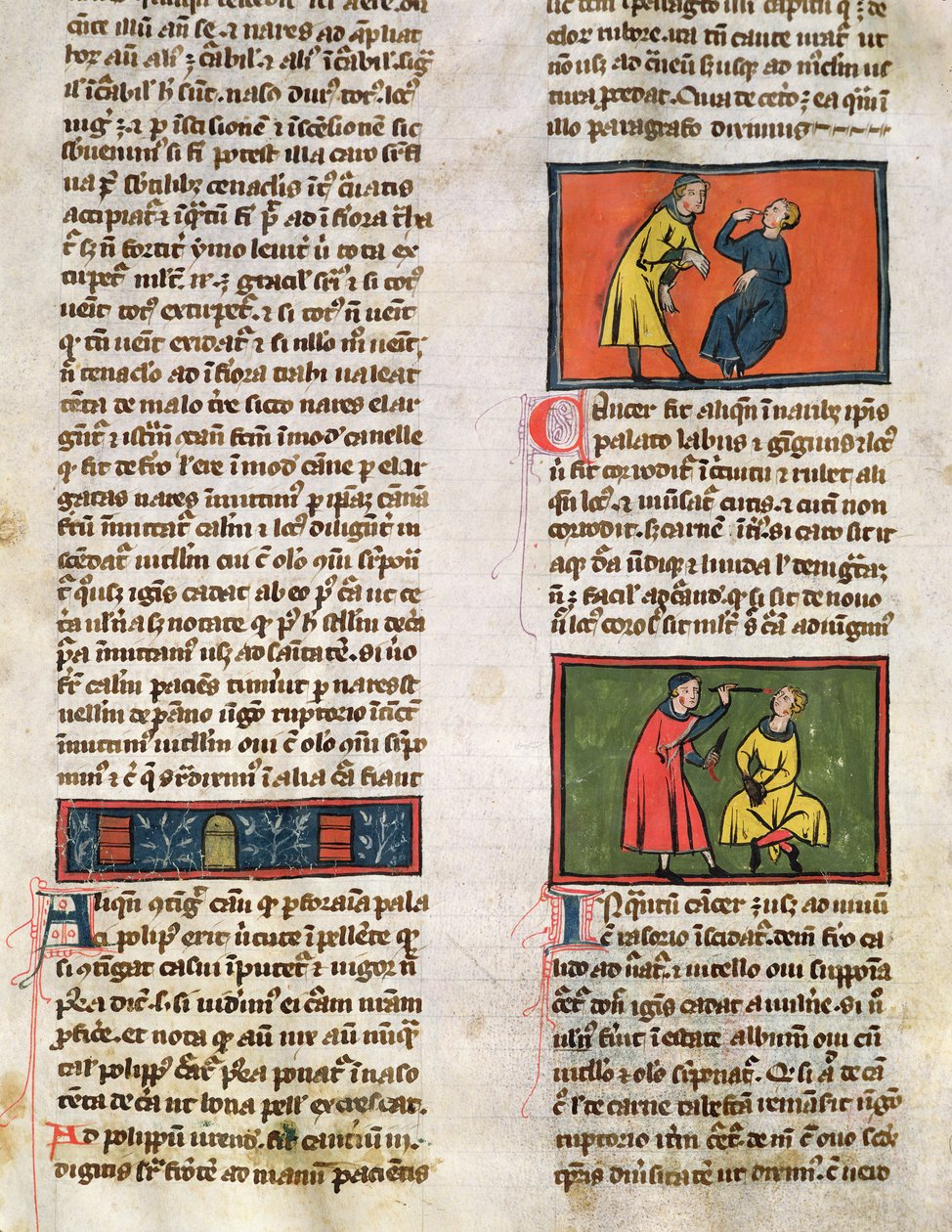 Ms H 89 Doctors and Patients, från en upplaga av Book of Surgery av Rogier de Salerne av French School