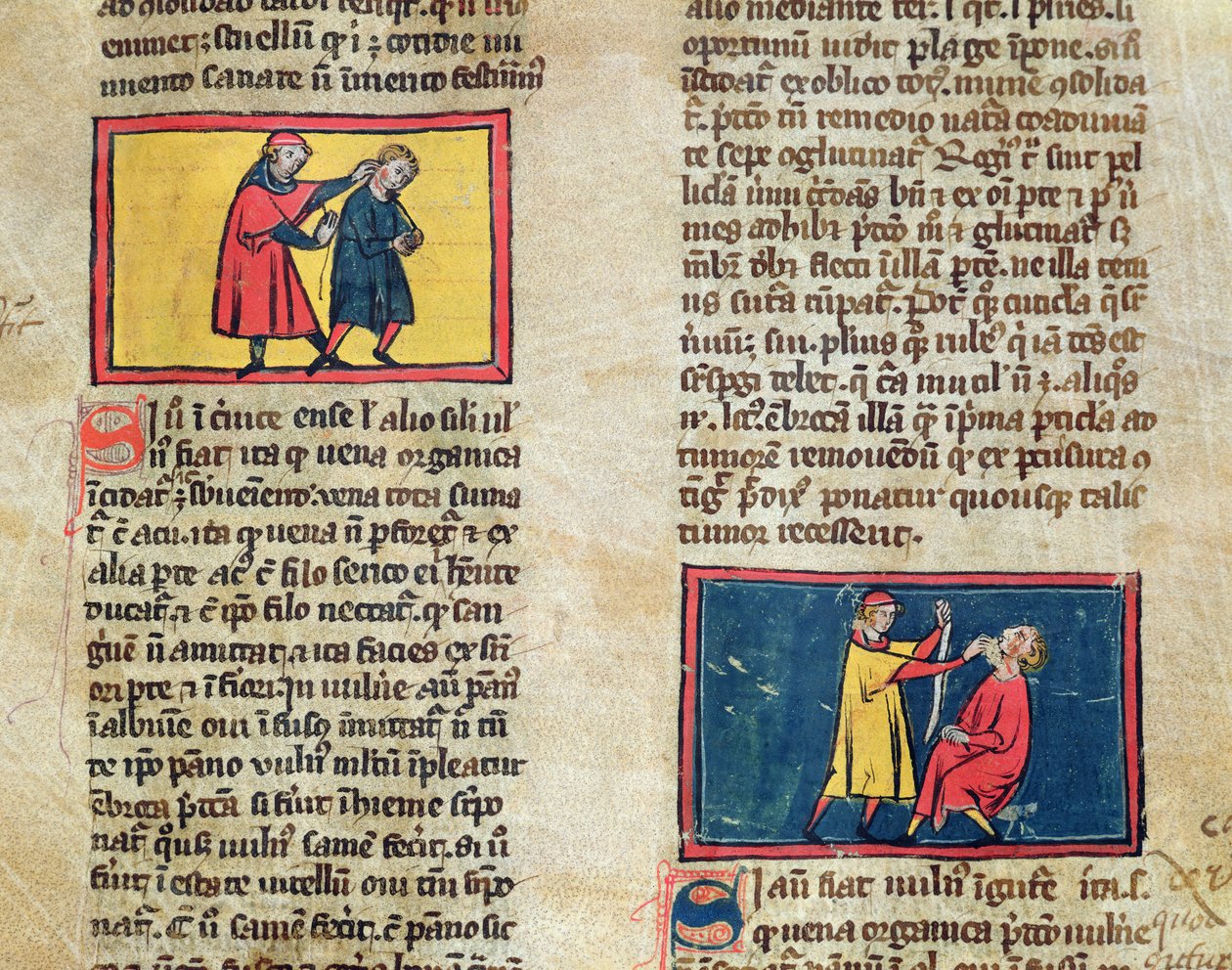 Ms H 89 Läkare och patienter, från en upplaga av Book of Surgery av Rogier de Salerne av French School