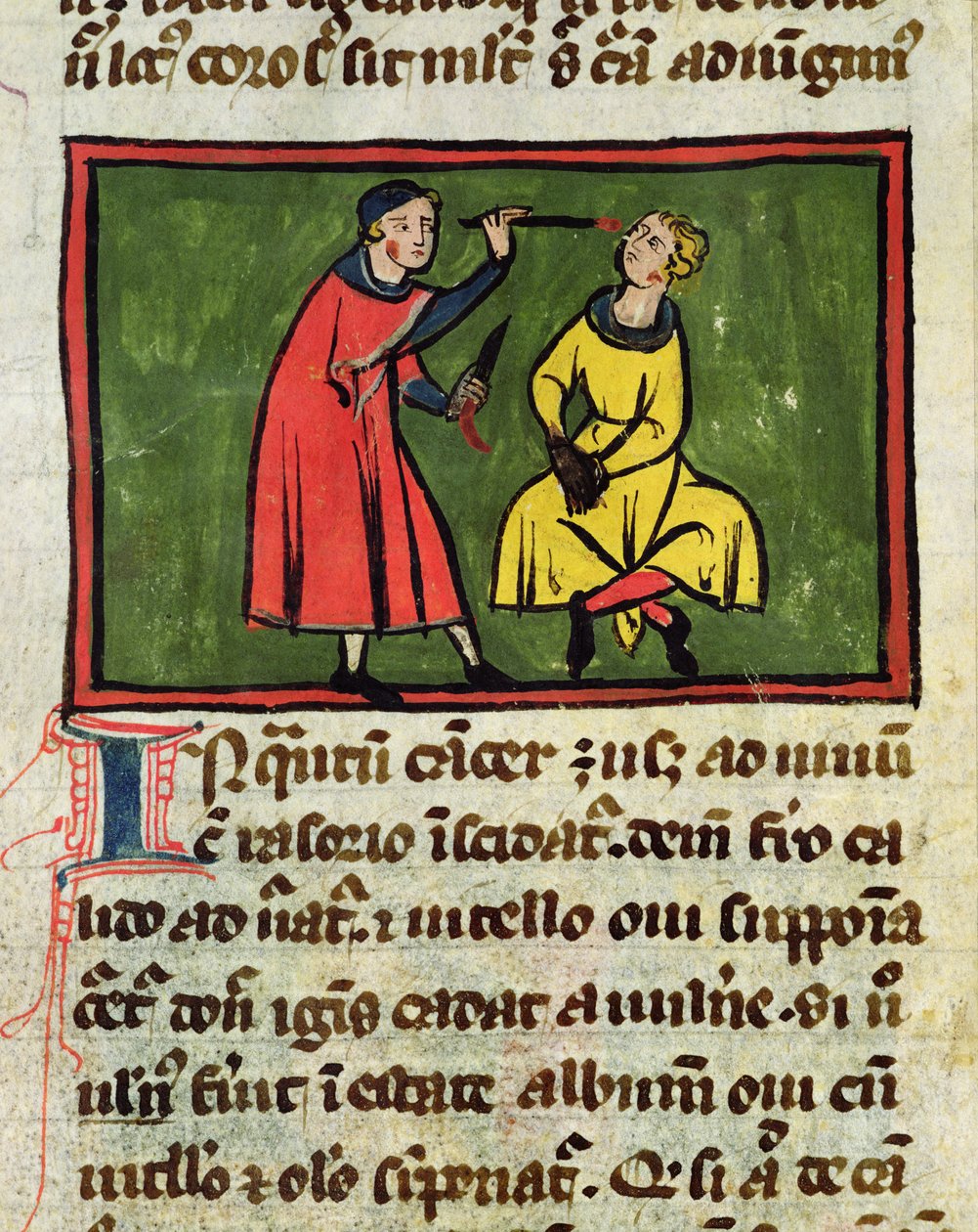 Ms H 89 Kirurgisk behandling, från en upplaga av Book of Surgery av Rogier de Salerne av French School