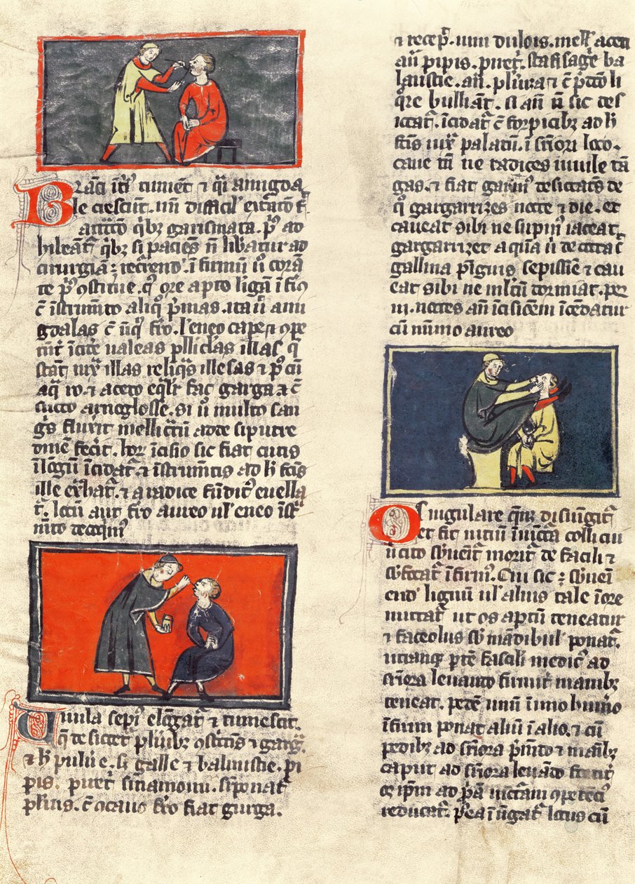 Ms H 89 fol.16v Dental Surgery, från en upplaga av "Book of Surgery" av Rogier de Salerne av French School