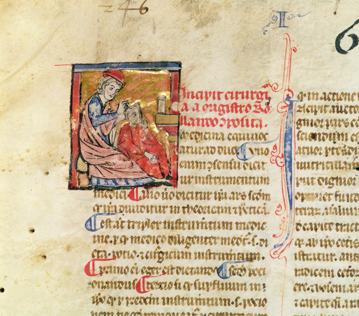 Ms Lat. 7134 fol.1 Trepanation, från Kirurgi av Maitre Rolandi av French School