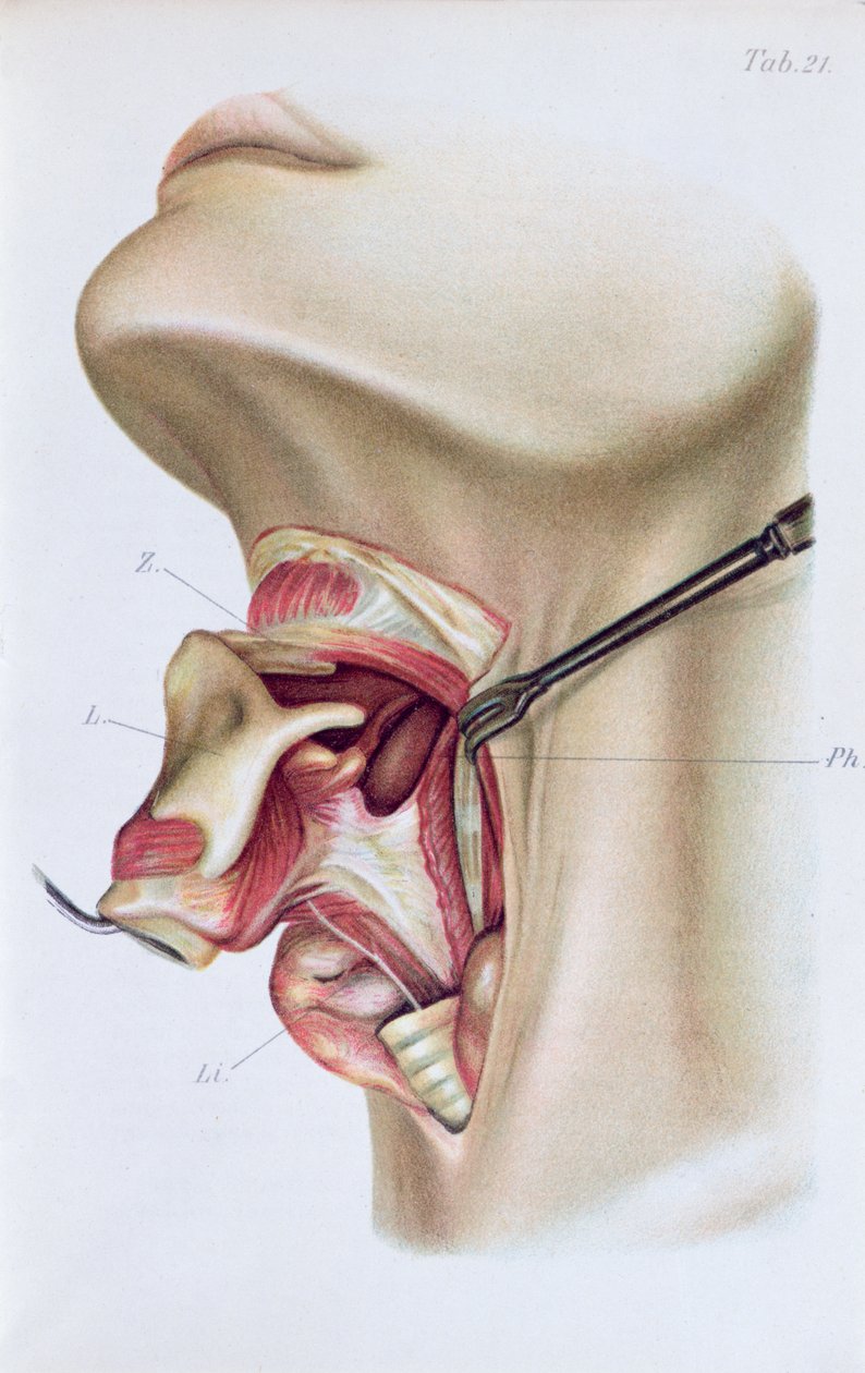 Plåt från Atlas and Epitome of Operative Surgery av Dr. Otto Zuckerkandl (1861-1921) 1910 av French School