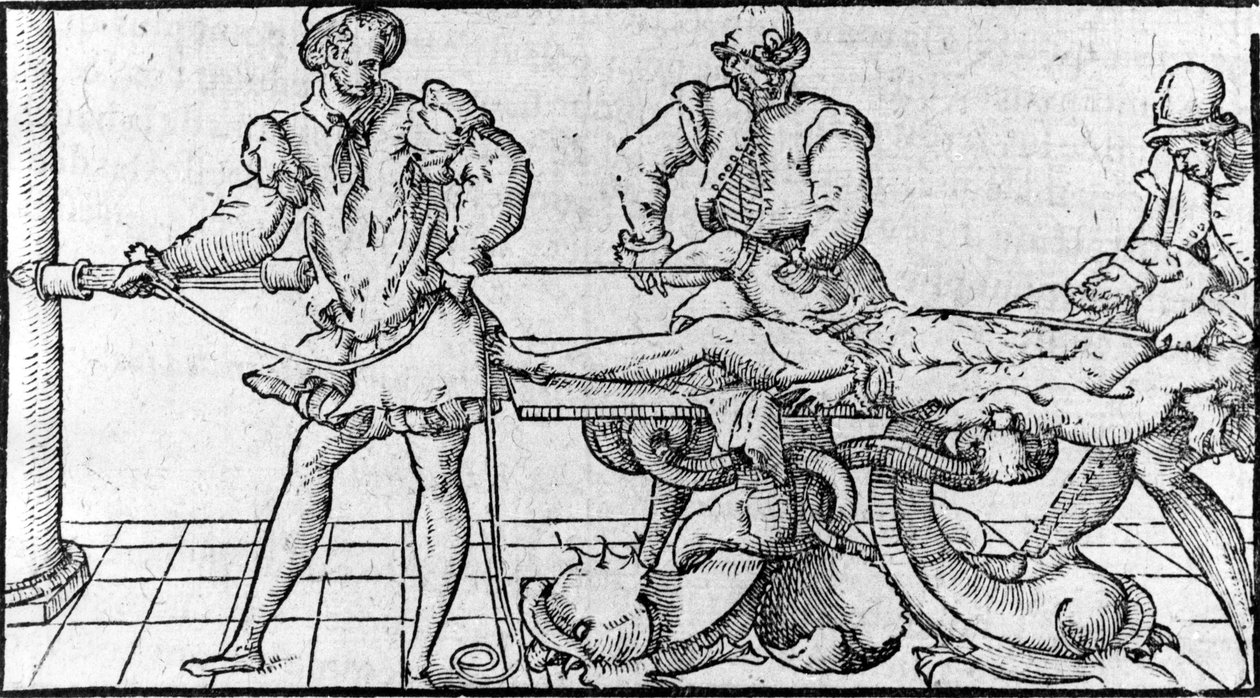 Minskning av dislokation, -i "Medical Treaty of Ambroise Paré"", cirka 1560. av French School