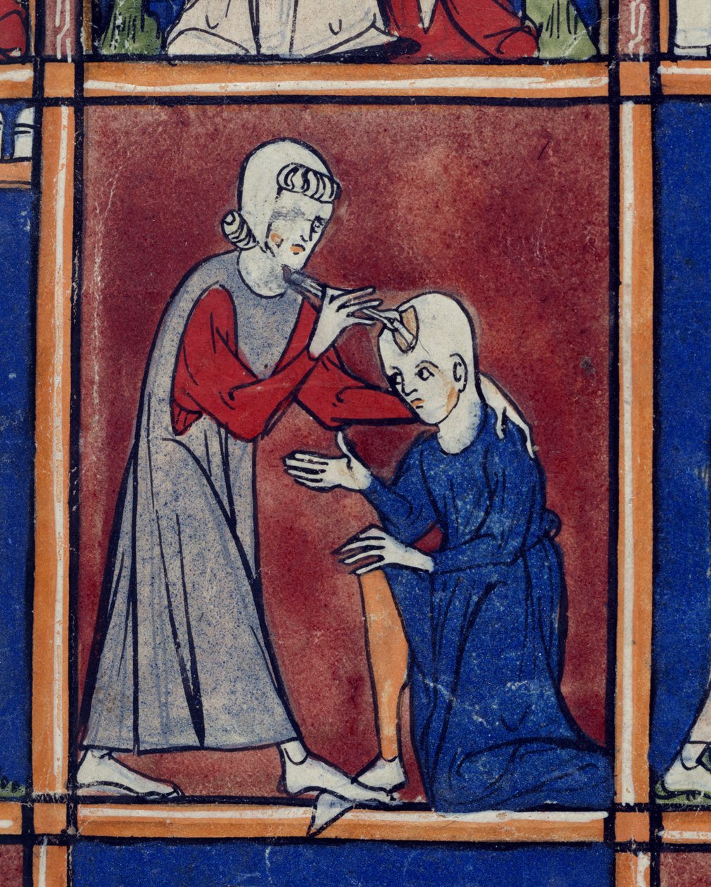 Sloane 1977 f.2 Operation på en patients skalle, illustration från 