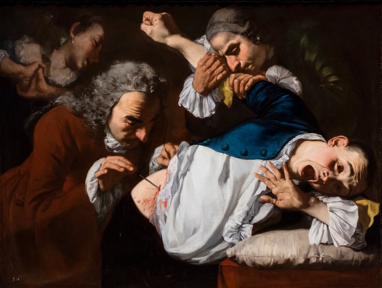 Operationen, cirka 1753/54 (Olja på duk) av Gaspare Traversi