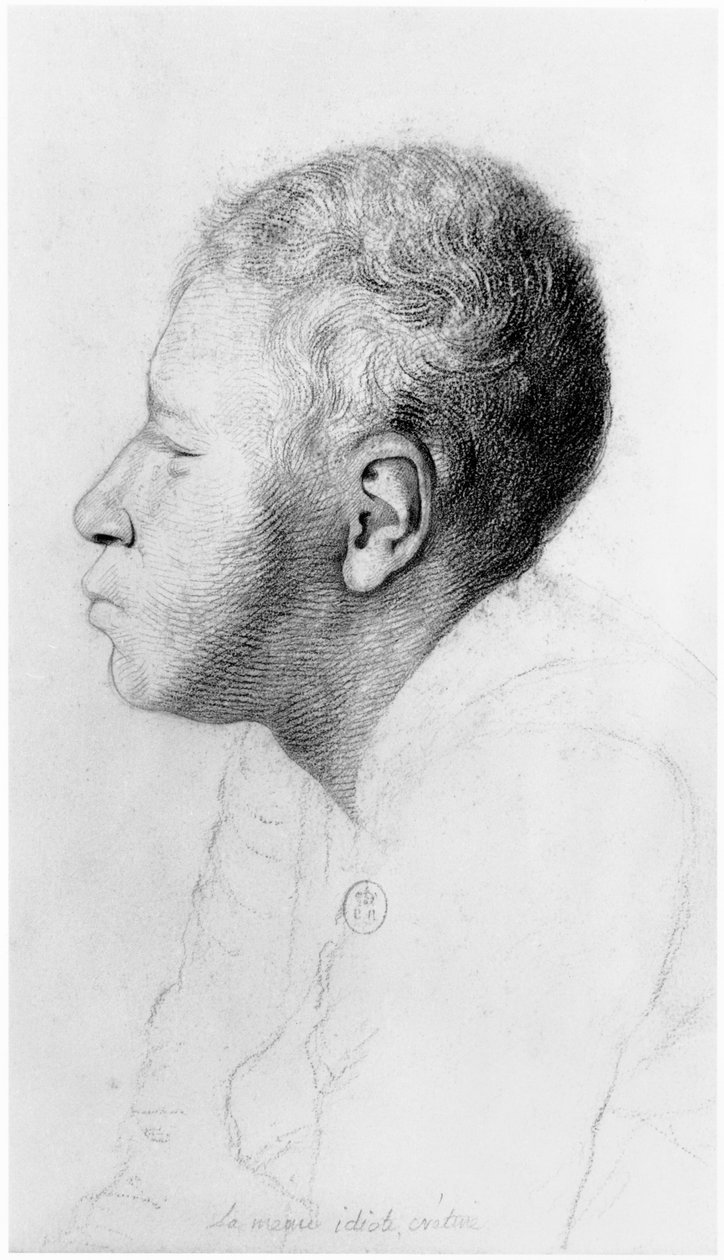 Cretin, profil, illustration från en opublicerad avhandling av Jean Etienne Dominique Esquirol (1772-1840) om galningarna på asylanstalten Salpetriere, ca 1818 av Georges Francois Gabriel