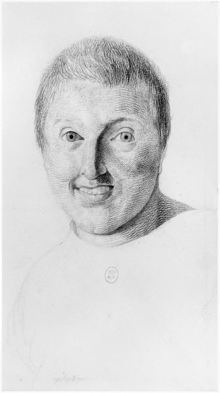 Epileptisk kvinna, framifrån, illustration från en opublicerad avhandling av Jean Etienne Dominique Esquirol (1772-1840) om galningarna på asylanstalten Salpetriere, ca 1818 av Georges Francois Gabriel