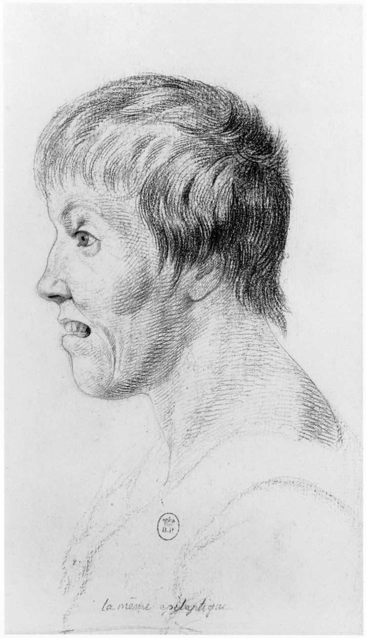 Epileptisk kvinna i profil, illustration från en opublicerad avhandling av Jean Etienne Dominique Esquirol (1772-1840) om de sinnessjuka på Salpetriere-anstalten, ca 1818 av Georges Francois Gabriel