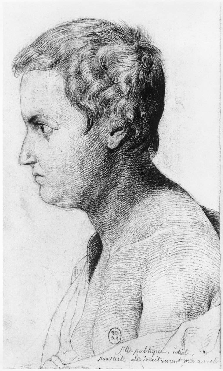 Idiotisk prostituerad som lider av syfilis, illustration från en opublicerad avhandling av Jean Etienne Dominique Esquirol (1772-1840) om galningarna på asylanstalten Salpetriere, ca 1818 av Georges Francois Gabriel