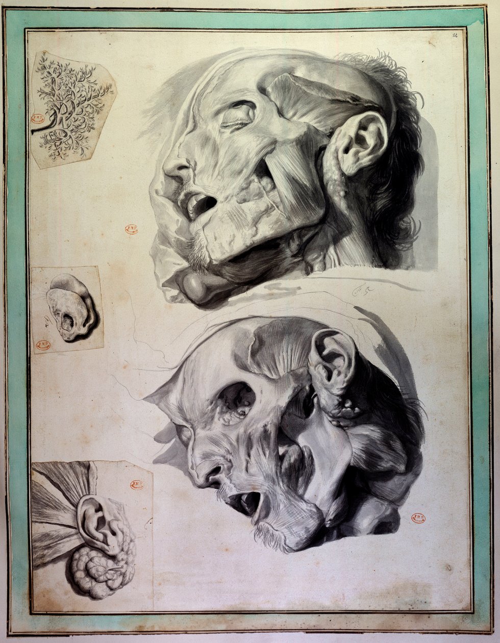 Avbarkade människohuvuden: muskler och skelett är synliga. Gravyr av Gerard de Lairesse (1640-1711) som illustrerar "Anatomia Humani Corporis" av Govert Bidloo (eller Govard) (1649-1713) Medicinska fakultetens bibliotek från 1700-talet, Paris av Gerard de Lairesse