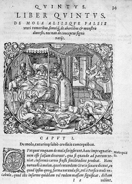 Efter födelsen, illustration från kapitel 1, bok 5 i Rueffs "Om människans uppkomst och utveckling", kapitel 1, bok 5. av German School