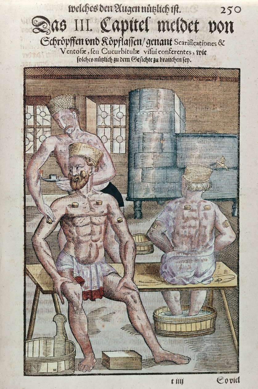 Koppning, från Ophthalmodouleia av Georg Bartisch (1535-1636) publicerad i Dresden 1583 (träblock i färg) av German School