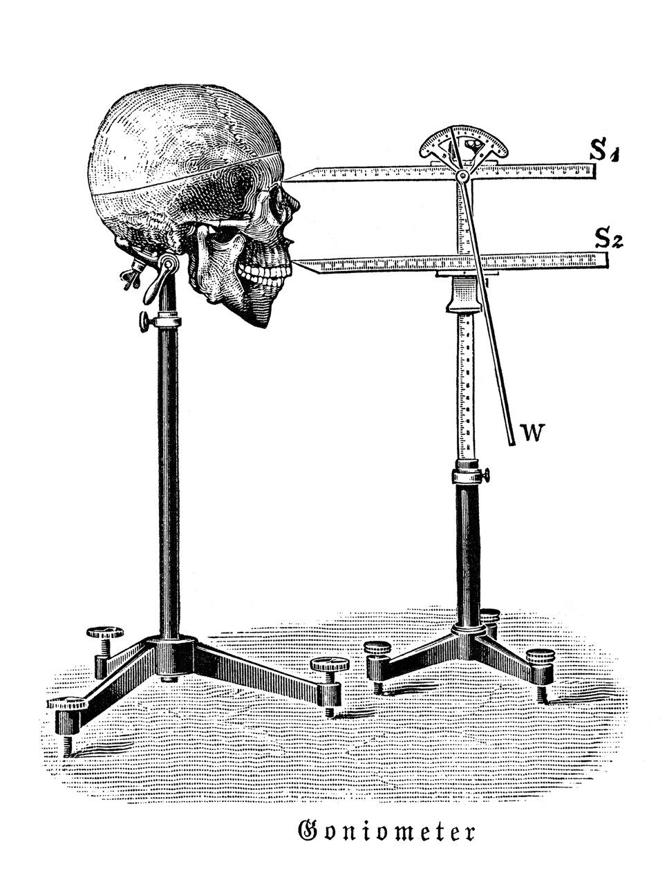 Goniometer som mäter mänsklig skalle av German School