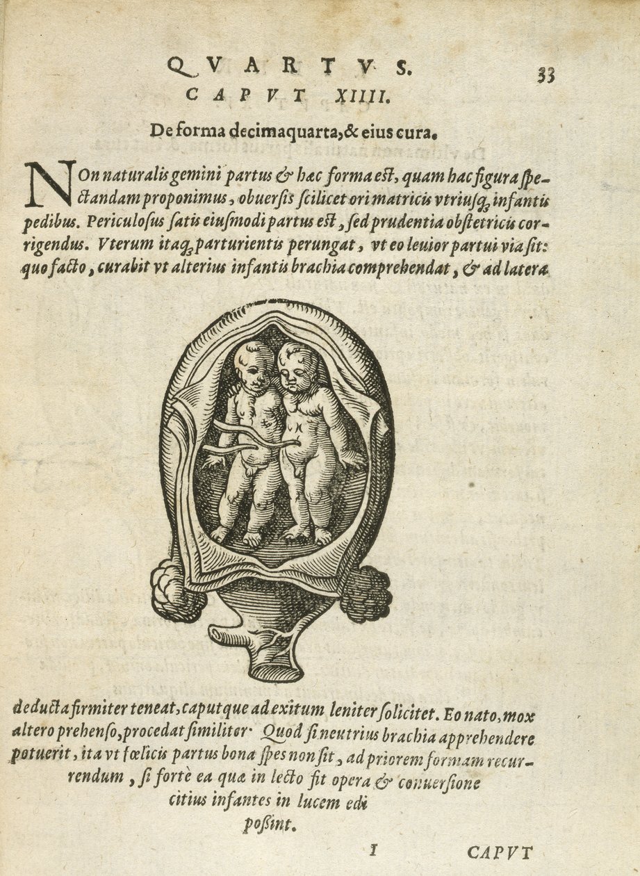 Icke-identiska tvillingar i livmodern, illustration från kapitel 14, bok 4 i On the Conception and Growth of Man av Rueff, 1587 av German School
