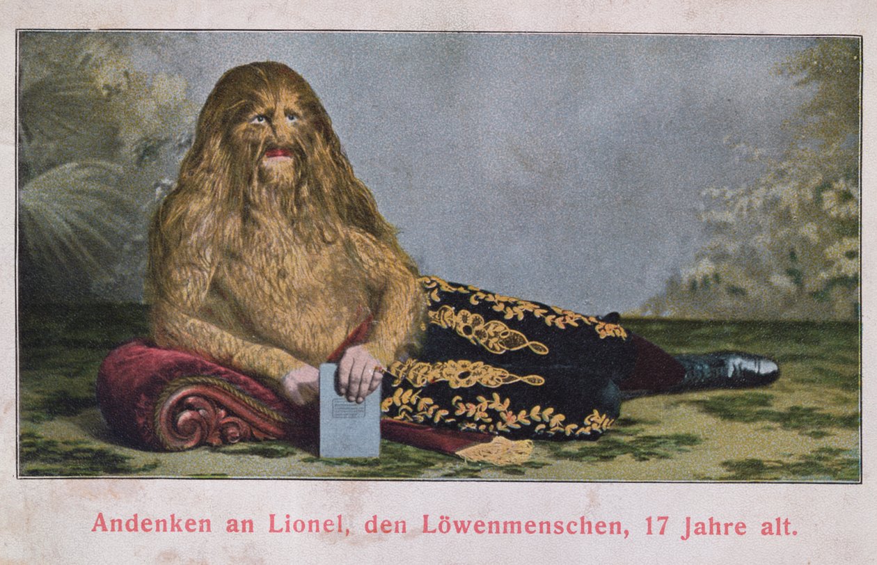 Vykort som föreställer Lionel the Lion Boy, 17 år gammal, 1909 av German School