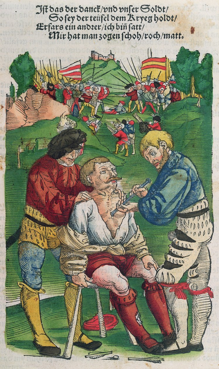 Att ta bort en pil, illustration från Feldtbuch der Wundartzney av Hans von Gersdorff, 1540 av German School