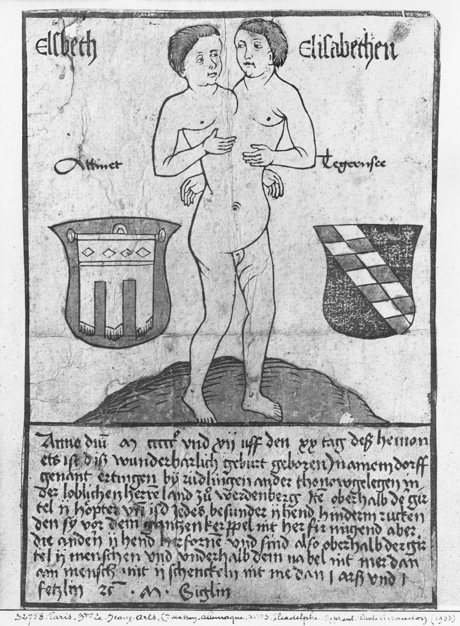 Siamesiska tjejer, Elsbeth och Elisabethen (träsnitt & wc) av German School