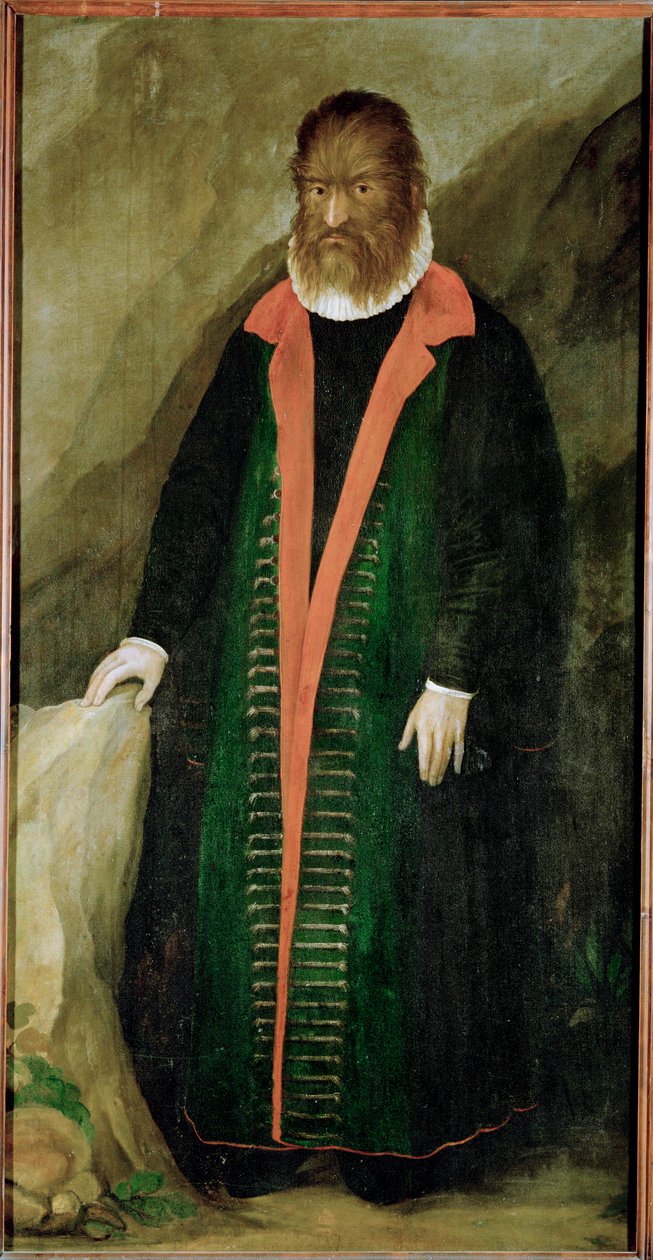 Den hårige mannen, Petrus Gonzalvus, född 1556 på Teneriffa ... av German School