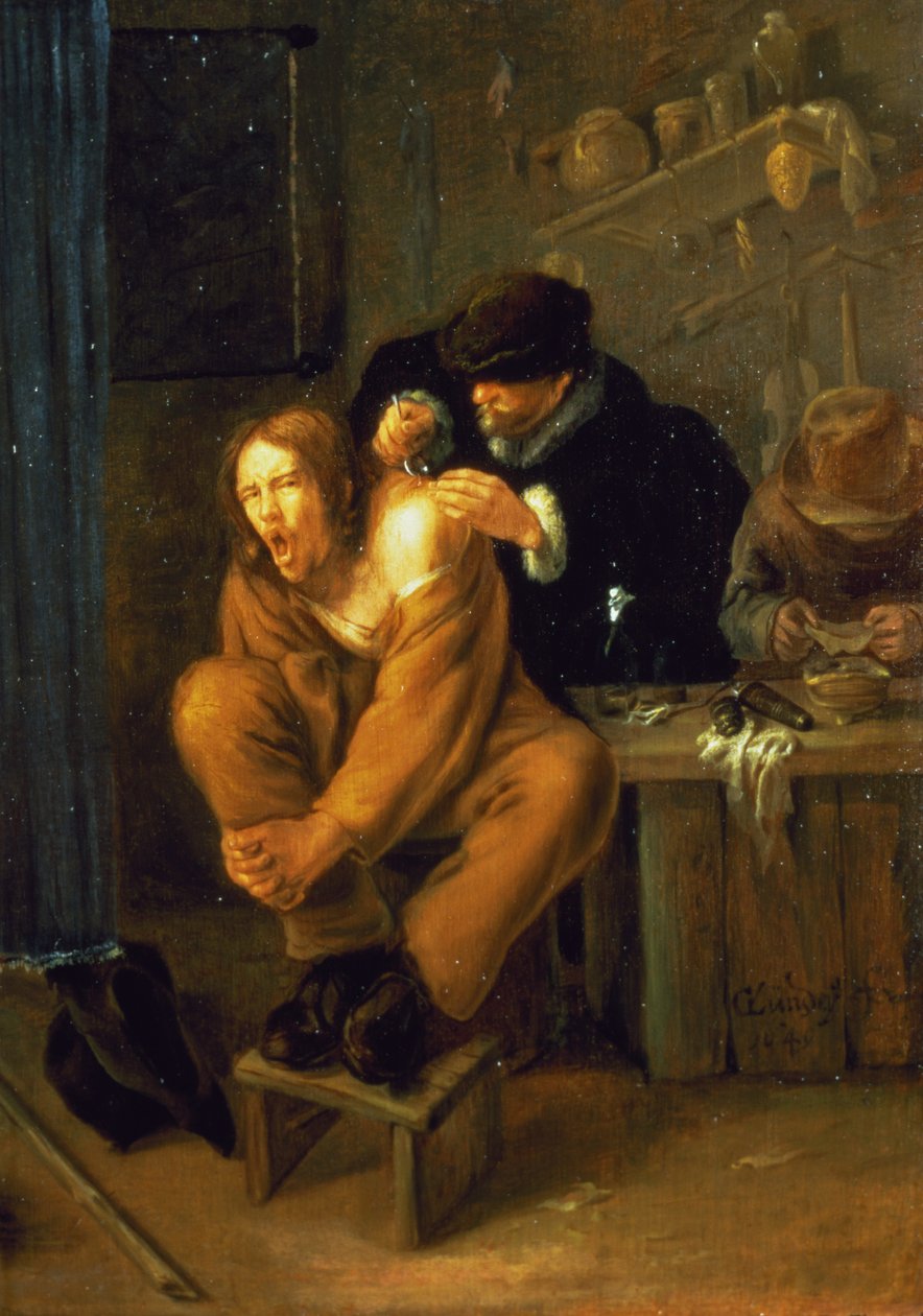 Kirurgen, 1649 av Gerrit Lundens