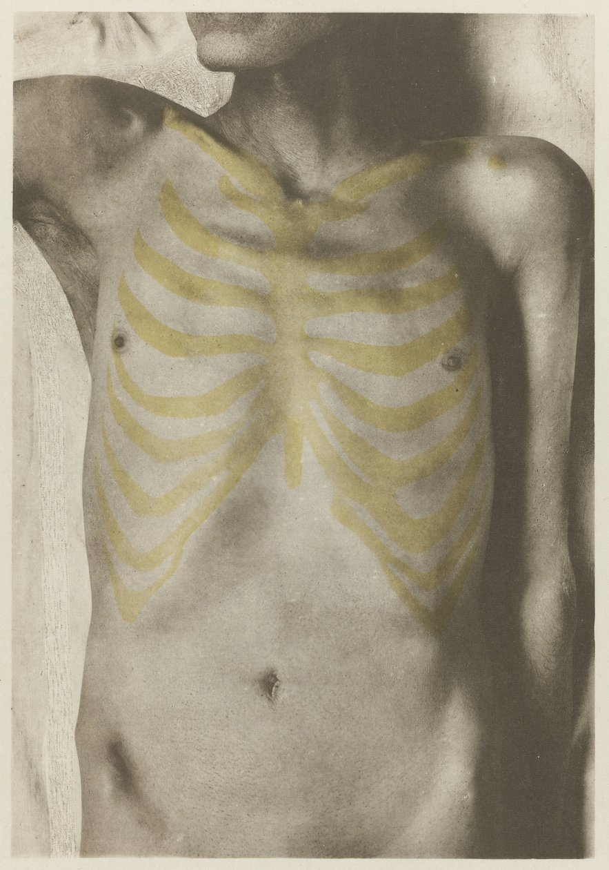 Anatomisk foto av een manlijk lijk: 