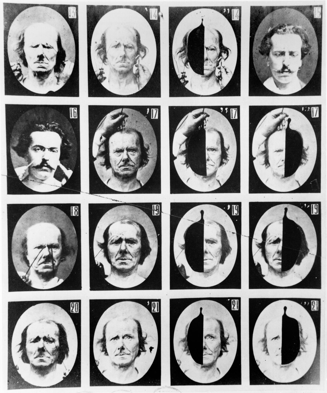 Fysionomiska studier, från "Mechanism of human physiognomy or electrophysiological analysis of passions" av Duchenne de Boulogne, publicerad 1876, Paris av Guillaume Benjamin Armand Duchenne de Boulogne