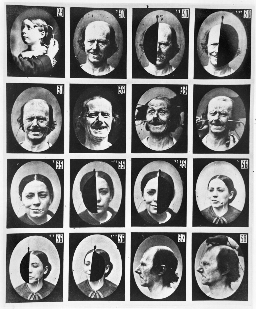 Fysiognomiska studier, ur "Mecanisme de la Physionomie humaine ou analyse electrophysiologique des passions" av Duchenne de Boulogne, publicerad 1876, Paris. av Guillaume Benjamin Armand Duchenne de Boulogne
