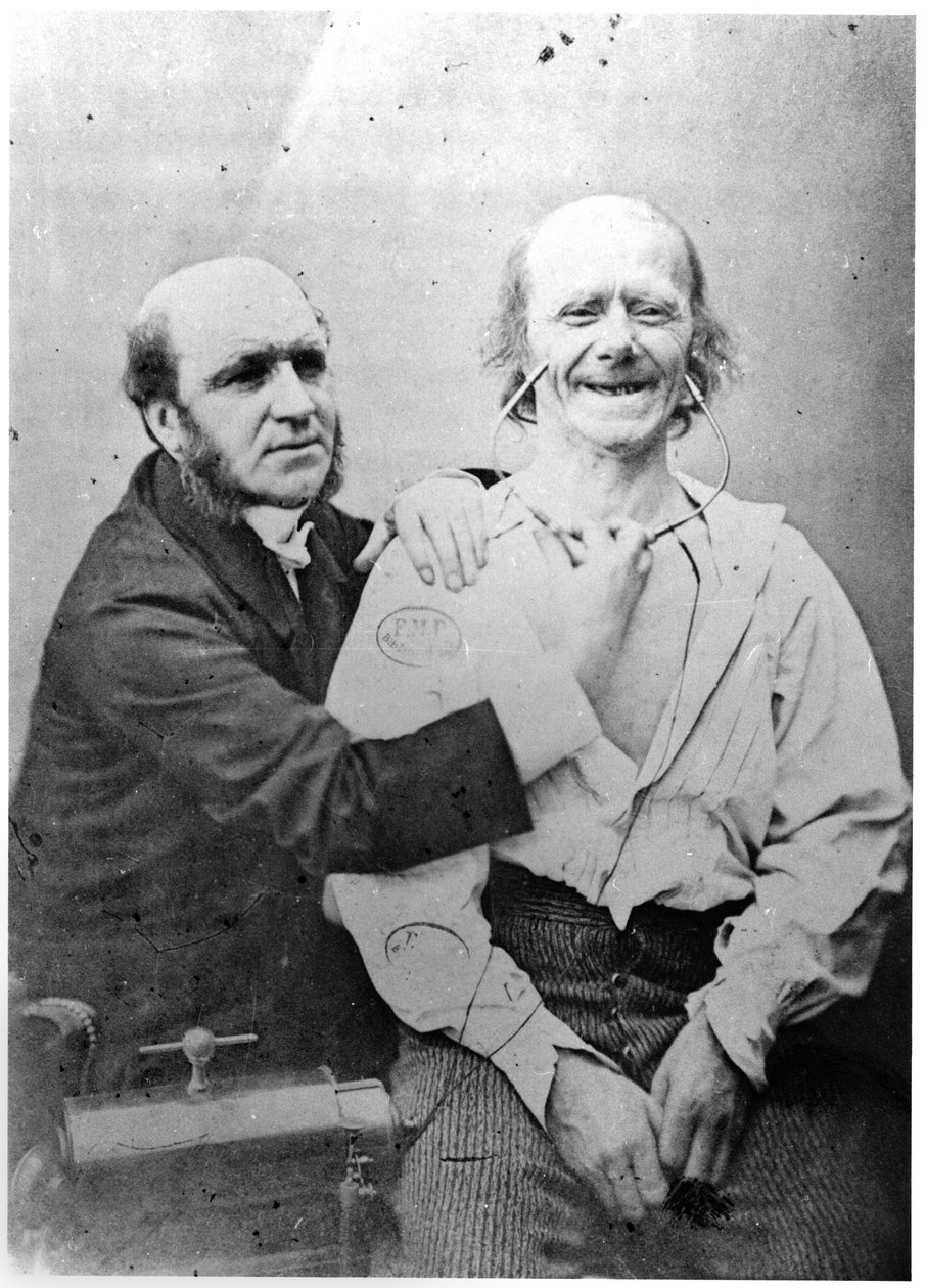 Faradisering av frontalmuskeln, från "Mecanisme de la physionomie humaine ou analyse electrophysiologique des passions" av Duchenne de Boulogne, publicerad 1876, Paris. av Guillaume Benjamin Armand Duchenne de Boulogne