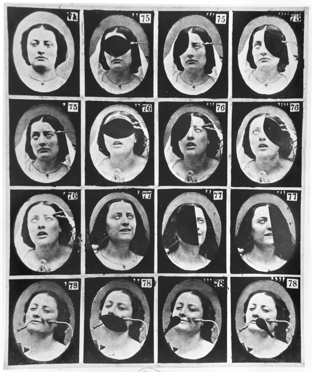 Fysiognomiska studier, ur "Mecanisme de la Physionomie humaine ou analyse electrophysiologique des passions" av Duchenne de Boulogne, publicerad 1876, Paris. av Guillaume Benjamin Armand Duchenne de Boulogne