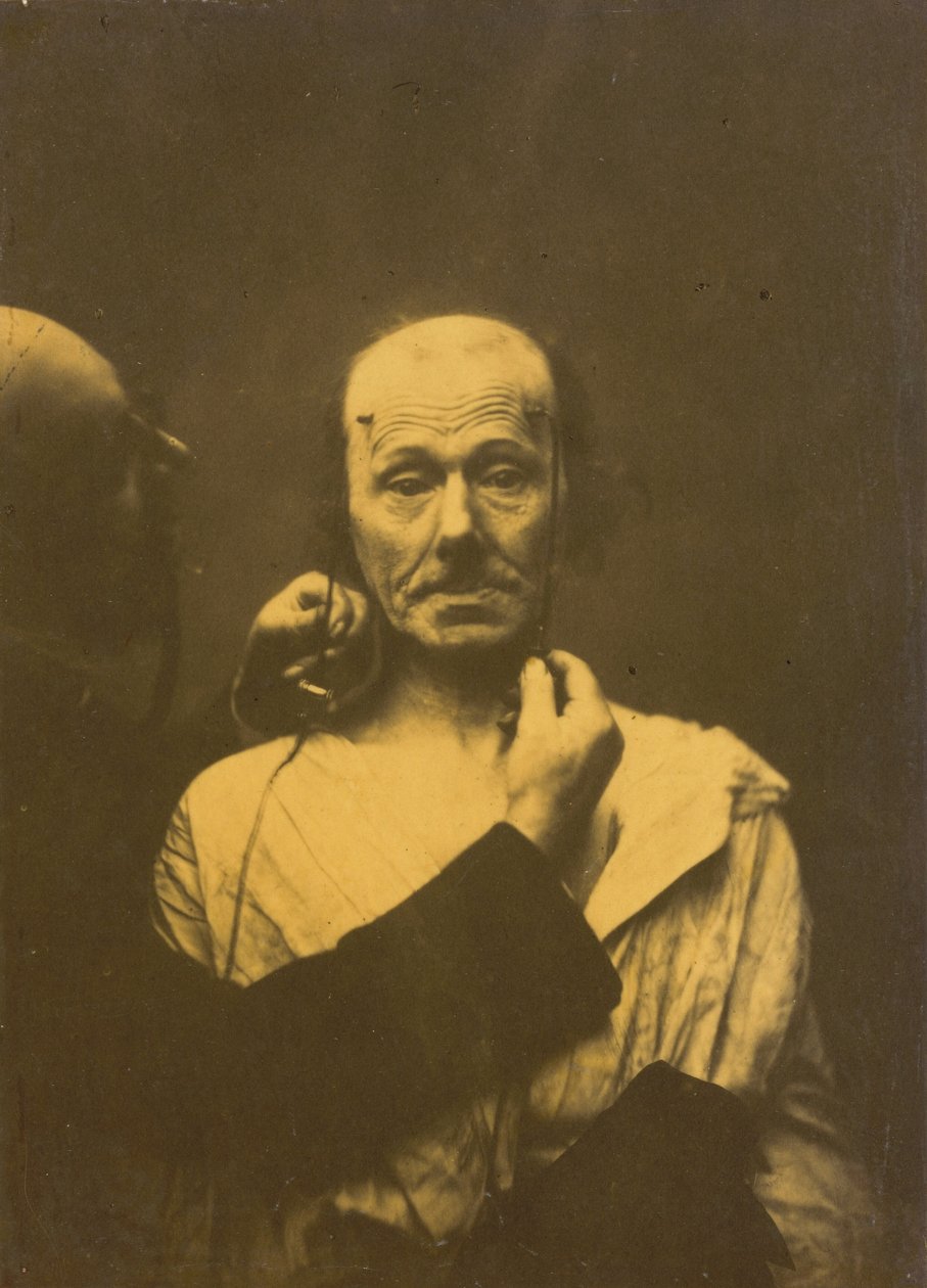 Uppmärksamhet,1854-1856, tryckt 1862 (foto) av Guillaume Benjamin Armand Duchenne de Boulogne