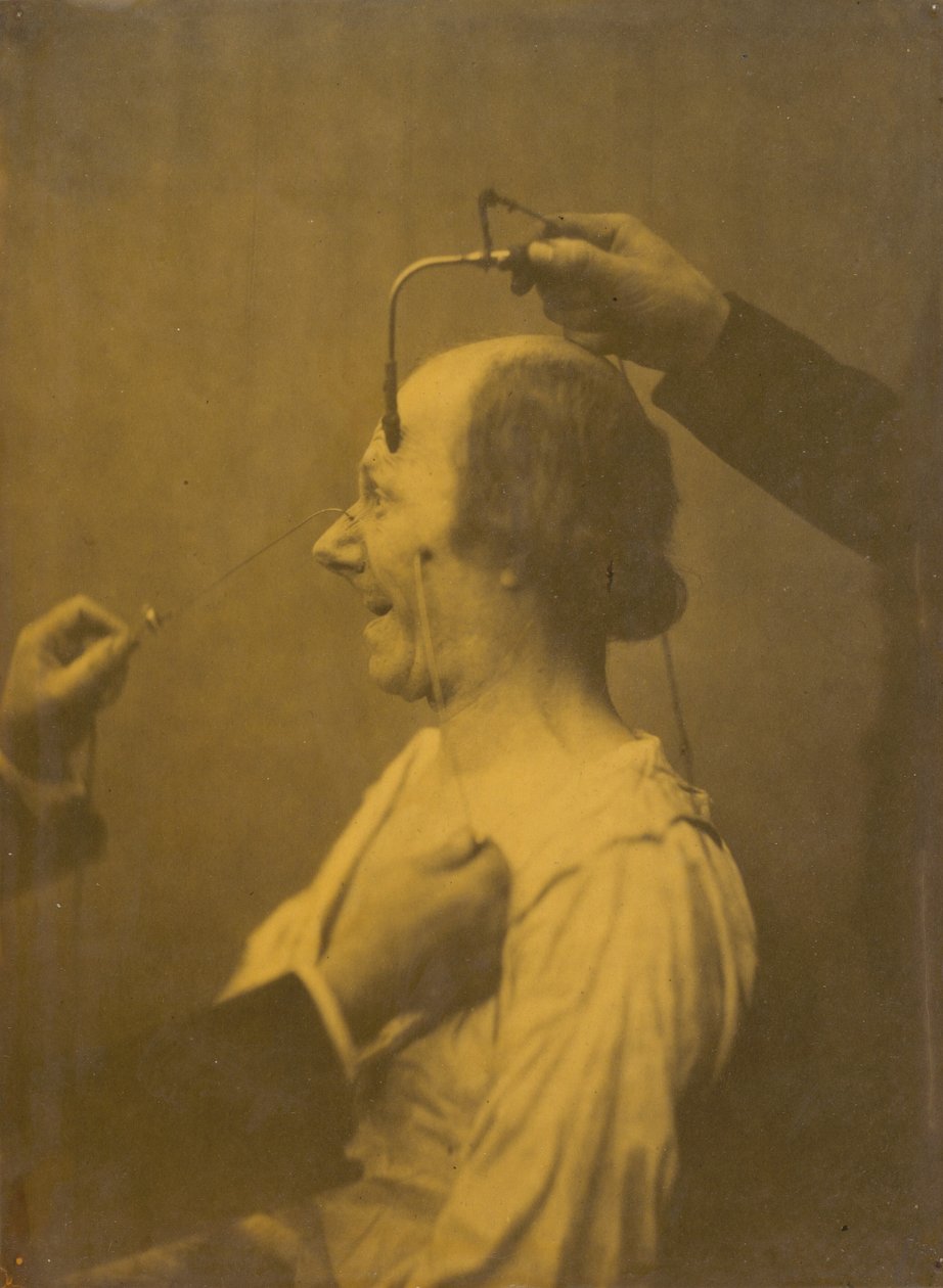 Uppmärksamheten som väcks av ett föremål som framkallar lustfyllda idéer och önskningar,1854-1856, tryckt 1862 (foto) av Guillaume Benjamin Armand Duchenne de Boulogne