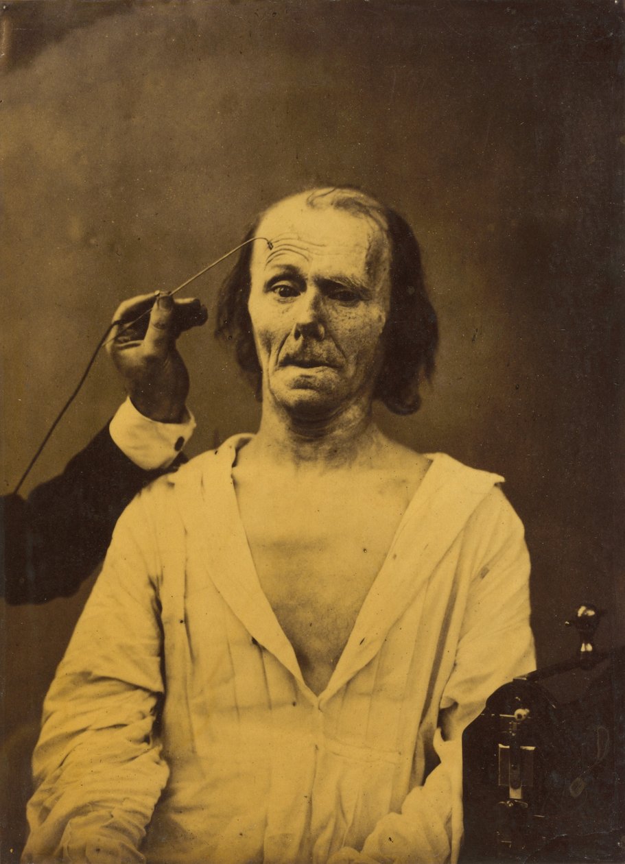Ett avslappnat ansikte (vänster); Djupgående uppmärksamhet (höger) av Guillaume Benjamin Amant Duchenne