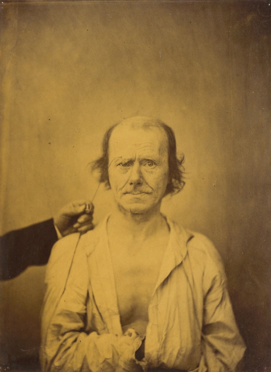 Uppmärksamhet (vänster); Reflektion (höger) av Guillaume Benjamin Amant Duchenne