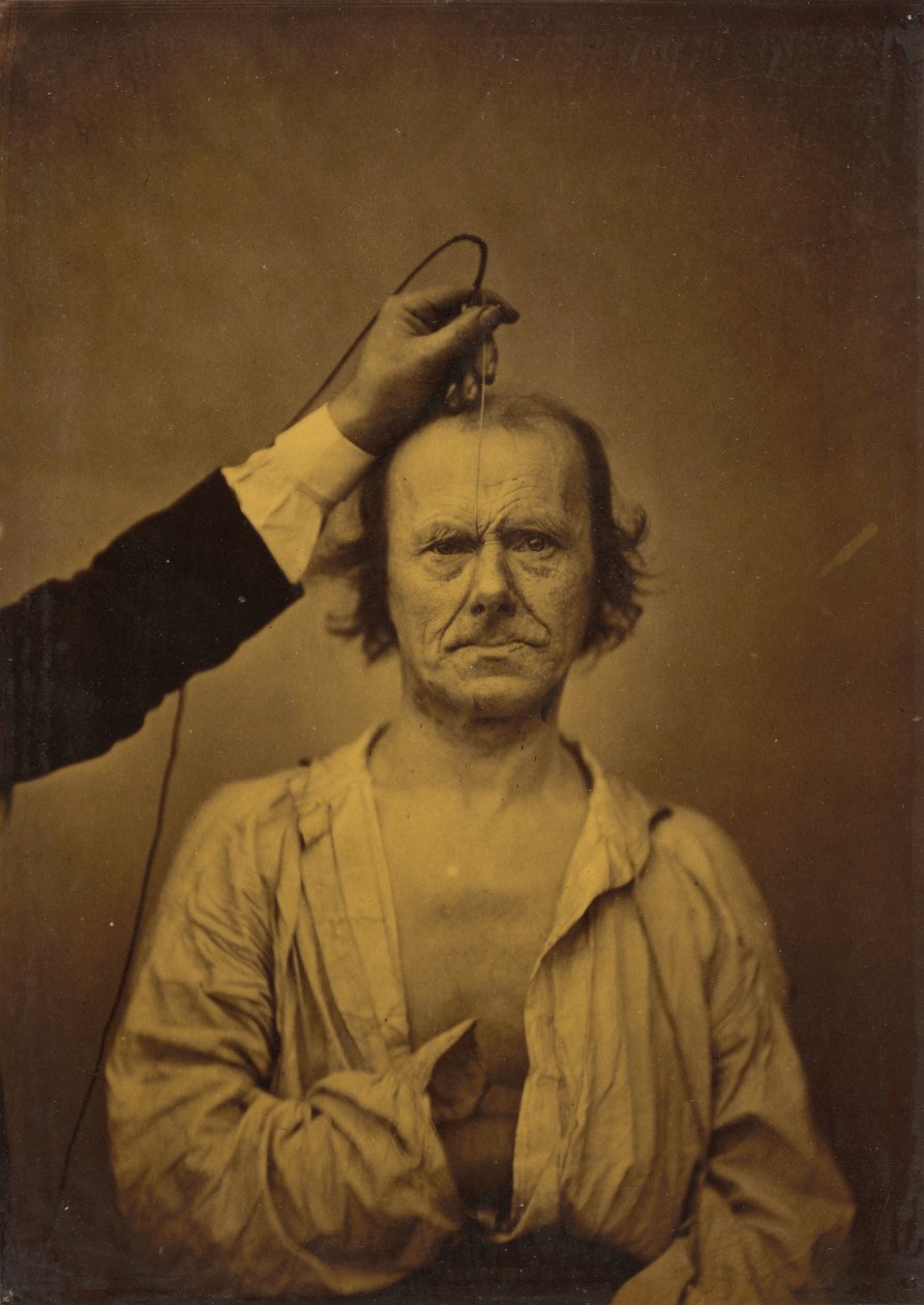 Uppmärksamhet (vänster); Allvarlighet, aggression (höger) av Guillaume Benjamin Amant Duchenne