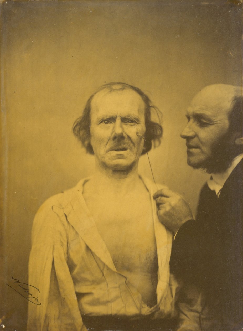 Gråter, medlidande tårar (vänster); Avslappnat ansikte (höger) av Guillaume Benjamin Amant Duchenne