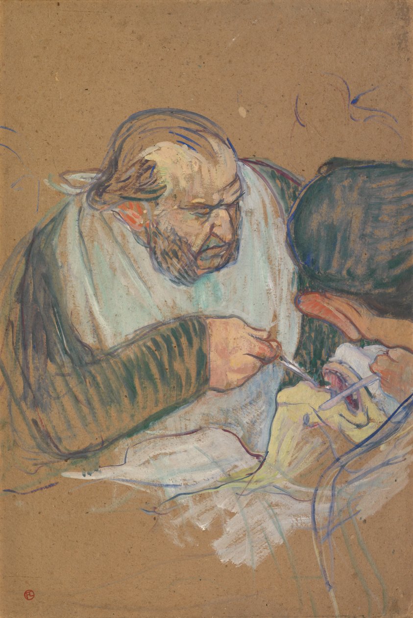 Dr Péan opererar av Henri de Toulouse-Lautrec