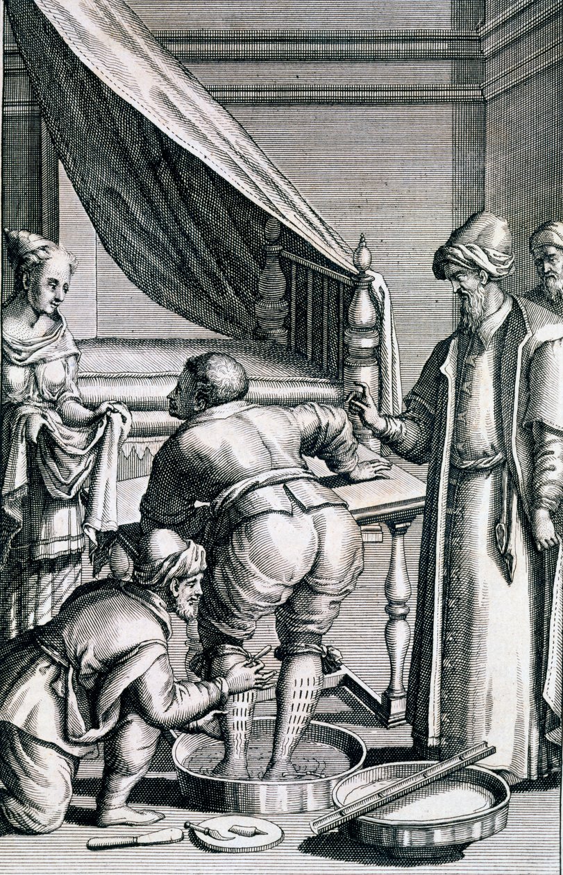 Blodsläpp i benen, från Medicina Aegyptiorum av Prospero Alpini, publicerad 1745 av Italian School