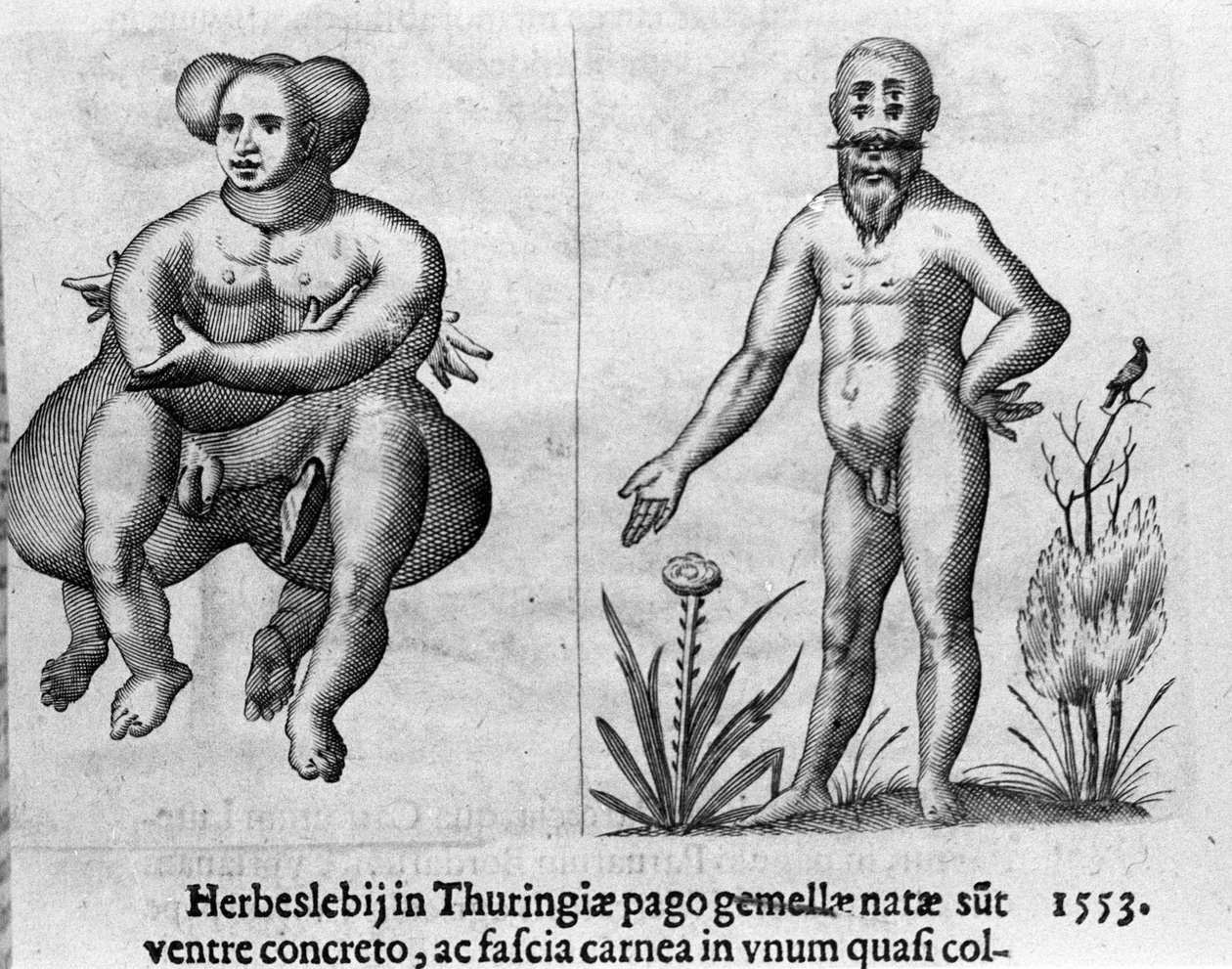 Olika typer av mänskliga monster. Gravyr från "Monstrens natur, deras orsaker och skillnader" av Fortunio Whilei (1577-1656), italiensk vetenskapsman. 1646 av Italian School