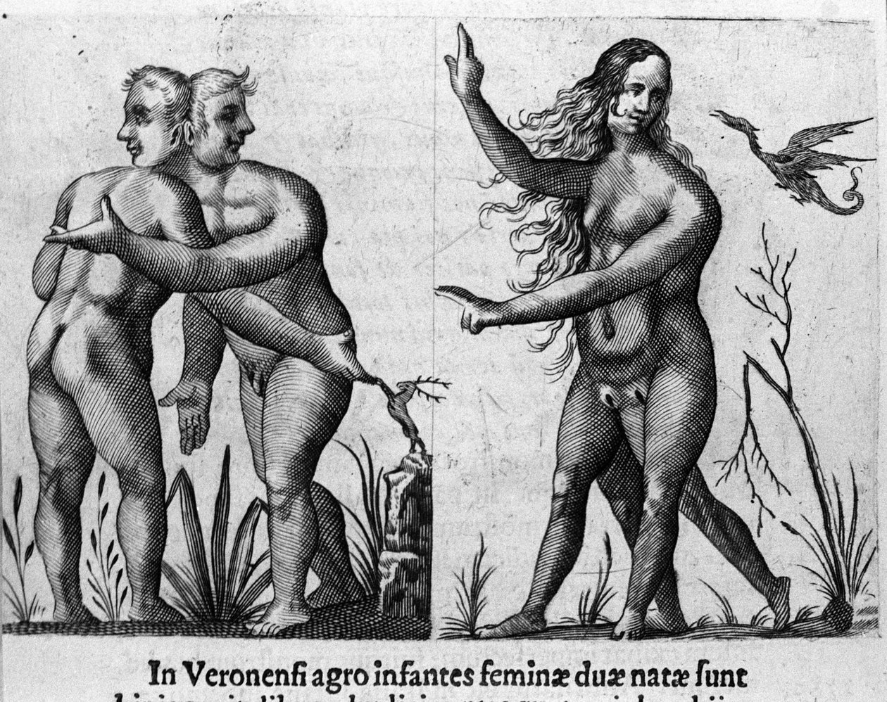 Olika typer av mänskliga monster: en man med dubbla kroppar och huvuden och en kvinna med fyra ben och två kön. Gravyr från "De monstrorum natura, causis et differentiis" av Fortunio Liceti (1577-1656), italiensk vetenskapsman. 1646 av Italian School