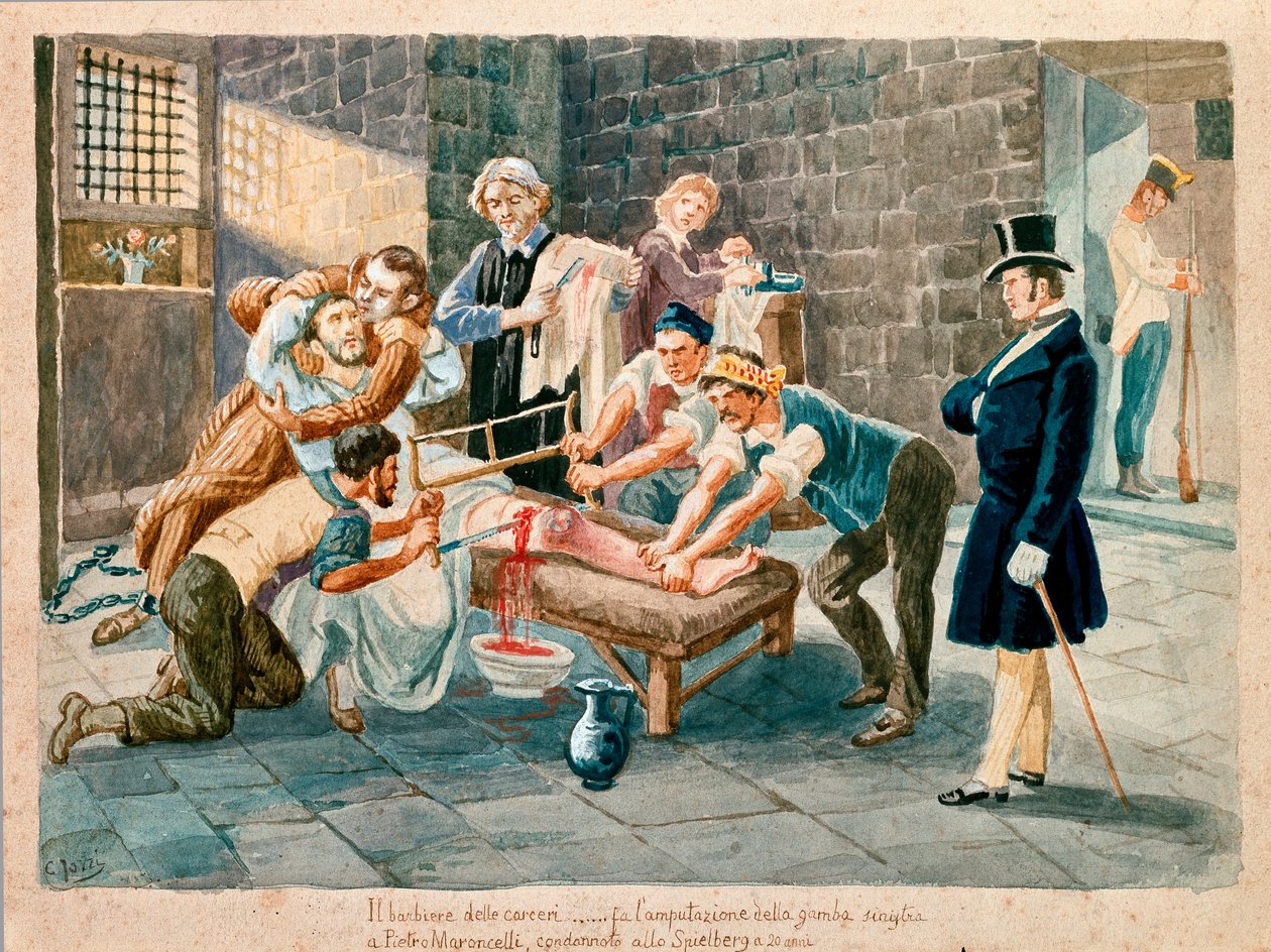 Patrioten och medlem av Carboneria (Carbonarism) Pietro Maroncelli (1795-1846) amputerades av sitt ben under sitt fängelse i penitenciern i fästningen Spielberg i Mähren. Tryck från 1800-talets Museo del Risorgimento, Milano av Italian School