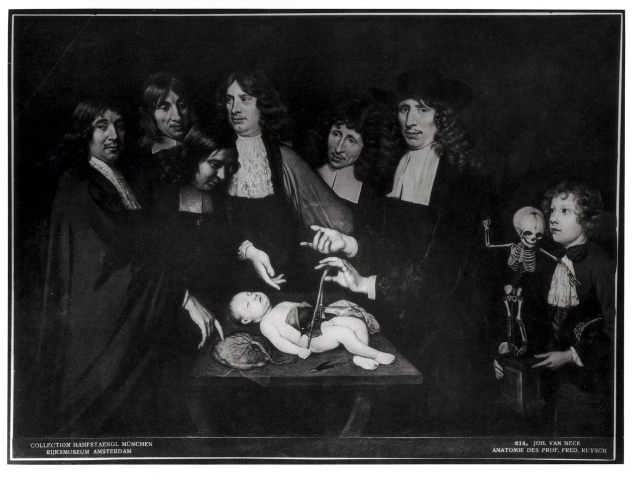 Anatomilektionen av professor Frederik Ruysch (1638-1731) ca 1683 av Jan van Neck